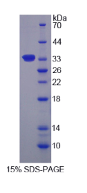 核糖体蛋白S6激酶α1(KL6Kα1)重组蛋白