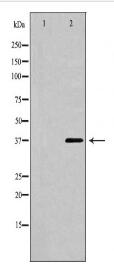 CTGF Antibody