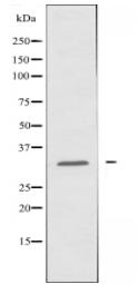 HCC1 Antibody