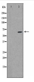 CSTF2T Antibody