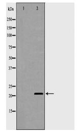 CDKN1A Antibody