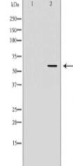 G6PD Antibody