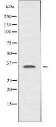 hnRNP A2/B1 Antibody