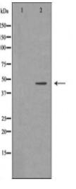 HFE2 Antibody