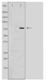GUSB Antibody