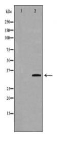 GNB2L1 Antibody