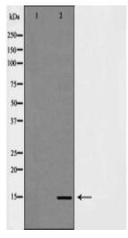 H3K14me3 Antibody