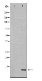 Histone H4K20me3 Antibody