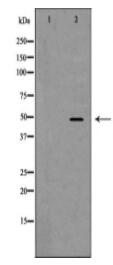 ENO2 Antibody