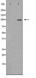 DLG2 Antibody