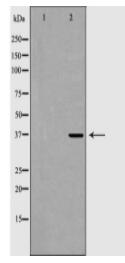 FBP1 Antibody