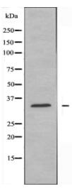GIMAP5 Antibody