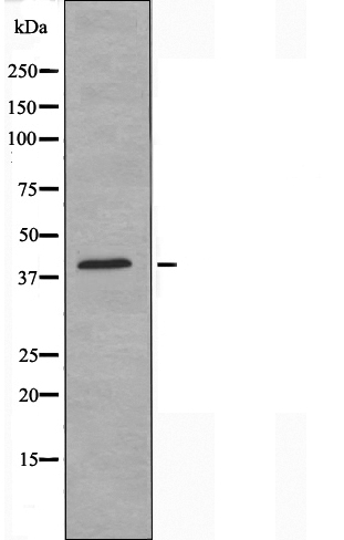 GPR17 Antibody