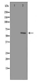 CYP1B1 Antibody