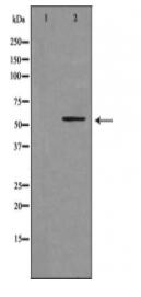 Cytochrome P450 39A1 Antibody