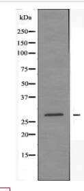 DHRS2 Antibody