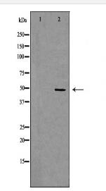 CSF2RA Antibody