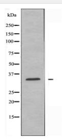 ELOVL6 Antibody