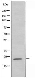 GUSBL1 Antibody