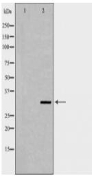 F11R Antibody
