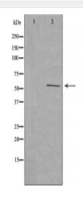 Cytochrome P450 2W1 Antibody