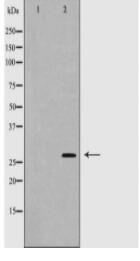 HLA-DQA1 Antibody