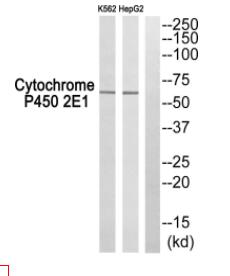 Cytochrome P450 2E1 Antibody