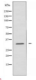 CTDSP1 Antibody