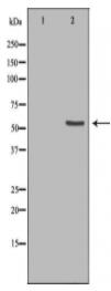 ETV6 Antibody