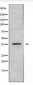 CYSLTR1 Antibody