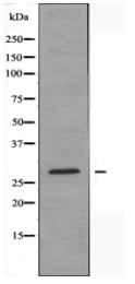FGF23 Antibody