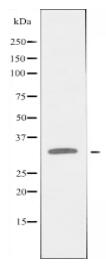 FOLR1 Antibody