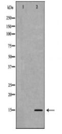 Histone H3K27me2 Antibody