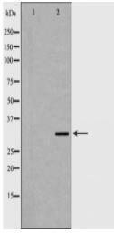 ERCC1 Antibody