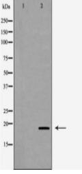 GTF2A1 Antibody