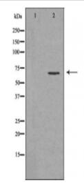 ENTPD1 Antibody