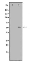 GDI1 Antibody