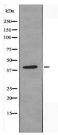 EDG5 Antibody