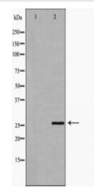 FAM3B Antibody