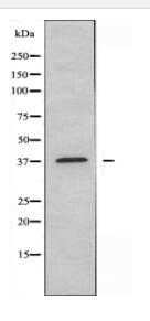 GIMAP2 Antibody