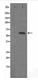 GPR101 Antibody