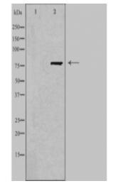 FZD6 Antibody