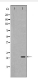 GLO1 Antibody