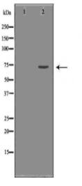 FOXO1 Antibody