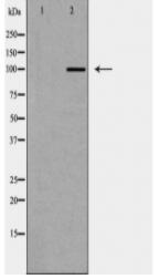 HK1 Antibody