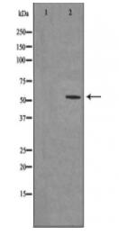 Cytochrome P450 2D6 Antibody