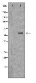 Dyskerin Antibody