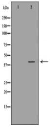 HMBS Antibody