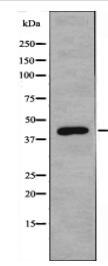 DHPS Antibody