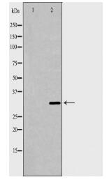 CCND2 Antibody